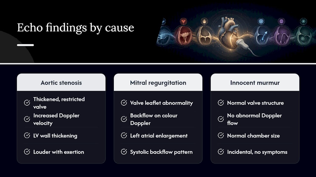 Diagram of echocardiogram findings matching murmur causes