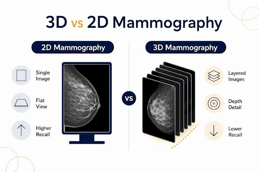 Infographic comparing 3D and 2D mammography features