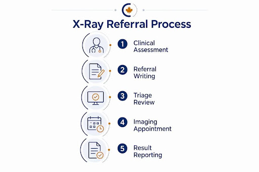 Infographic illustrating x-ray referral process steps